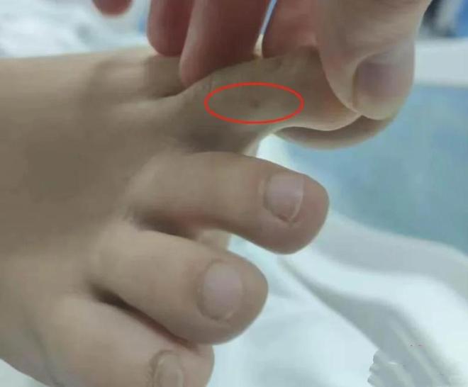 咬身亡好友道出更多细节救助博主涨粉百万PG麻将胡了试玩27岁女孩三亚被毒蛇(图8)